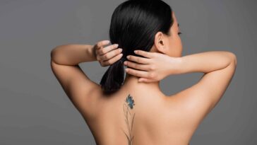 Best Time to Get a Tattoo Removed