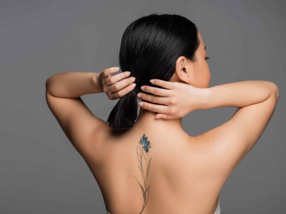 Best Time to Get a Tattoo Removed